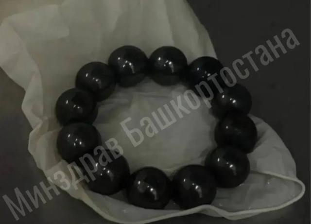 В Уфе хирурги спасли девочку, проглотившую магнитные шарики