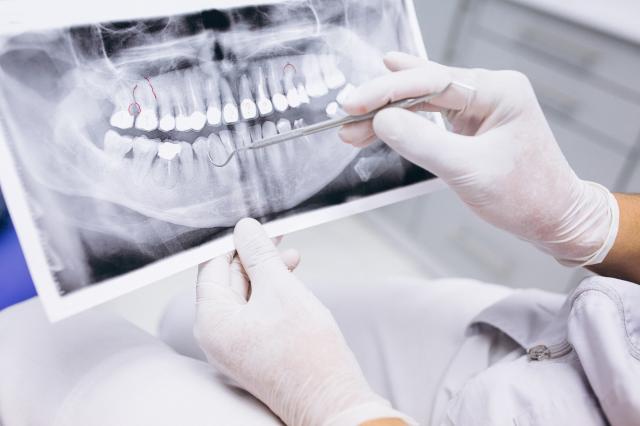 Жительнице Башкирии сломали челюсть в стоматологической клинике
