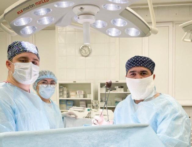 В Башкирии хирурги удалили у пациента камень размером с куриное яйцо