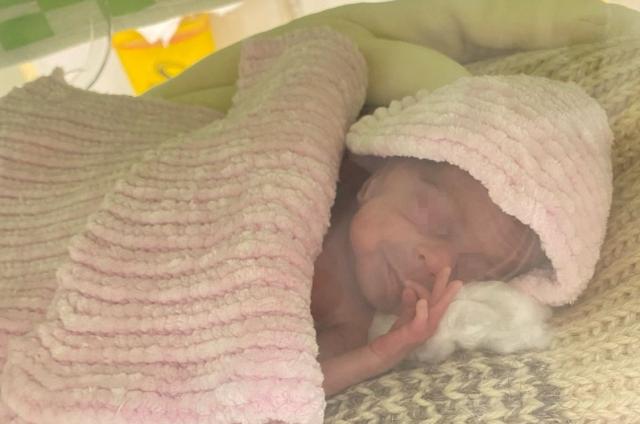 В Уфе врачи выходили новорожденную девочку, весом 490 грамм