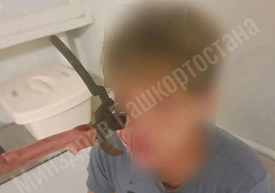В Башкирии спасли зрение подростка, которому в лицо попал садовый секатор